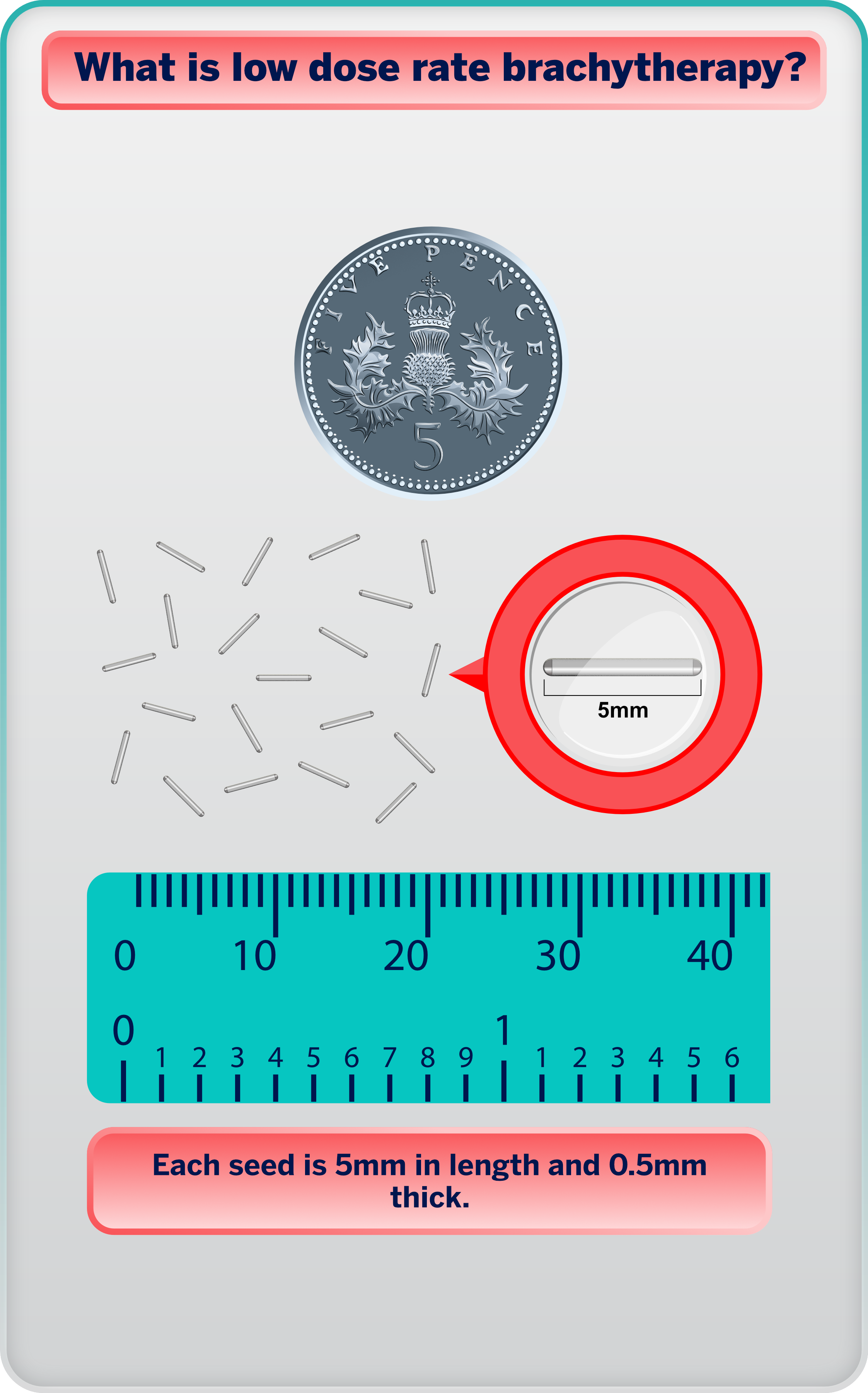 brachytherapy seeds against a 5 pence piece and ruler