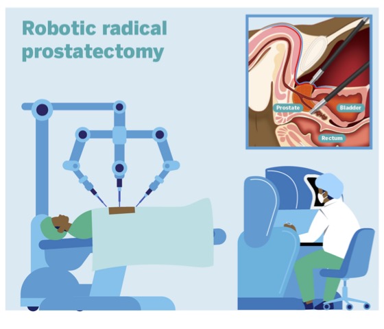 Robotic prostatectomy