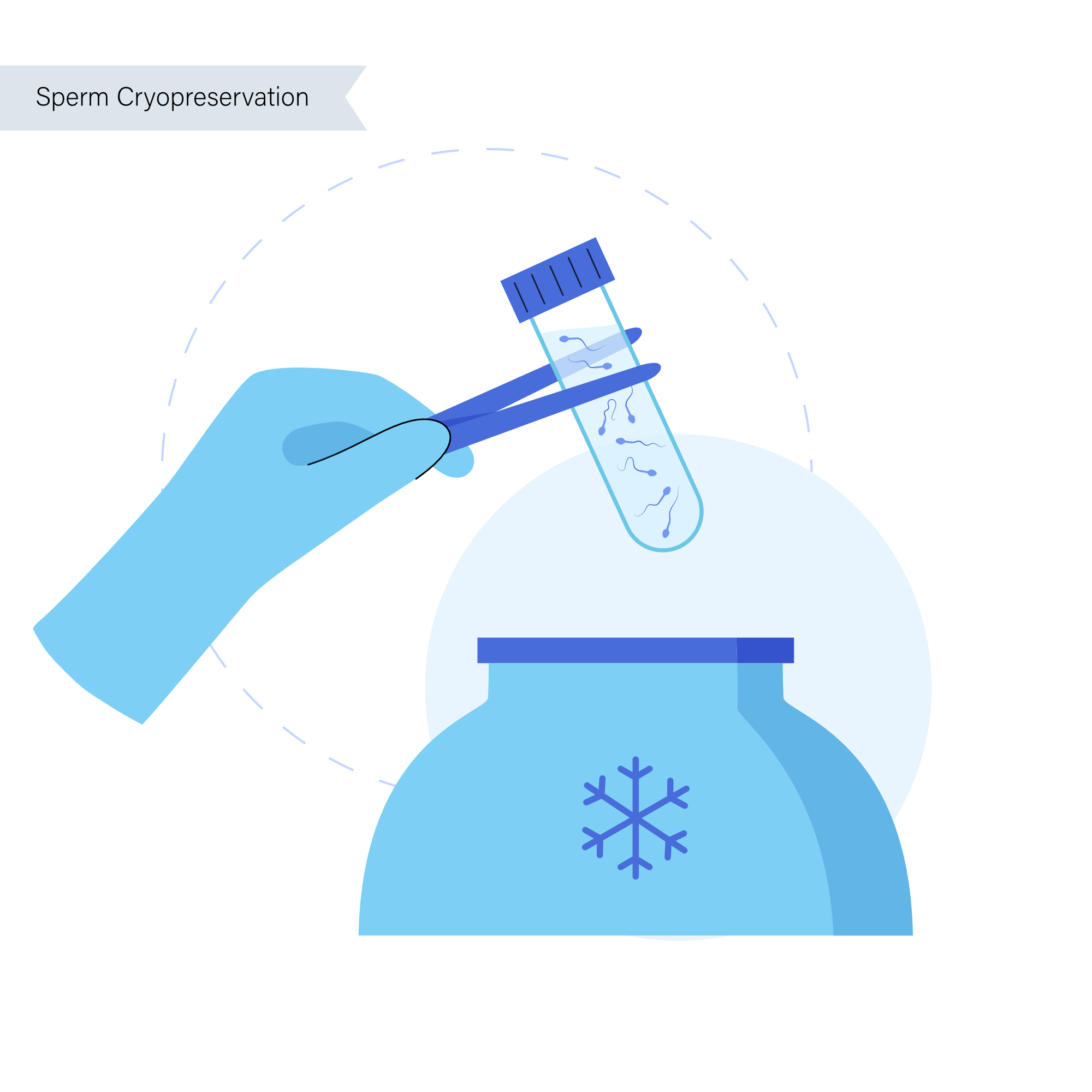 Sperm banking illustration