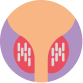 Low Dose Rate Brachytherapy