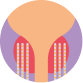 High Dose Rate Brachytherapy