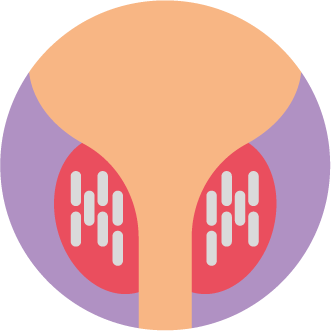 LDR Brachytherapy